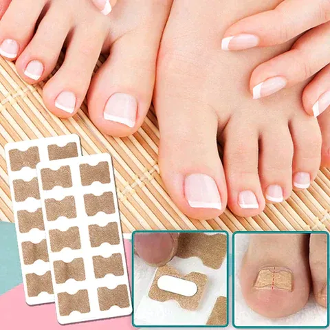 Nail Correction Patches™